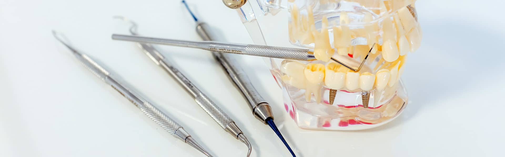 Clinica Dentaria DDI Periodontologia